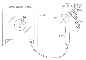 robot_artas®_patent
