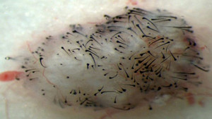 haircell