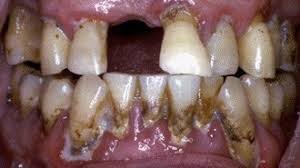 teeth