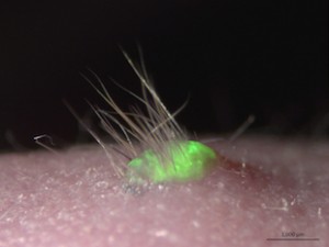 stem