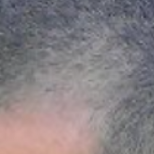 corner hairline shaved
