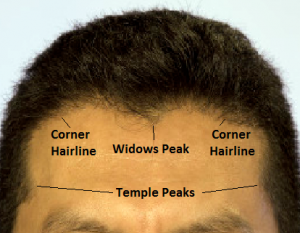 hairline labels