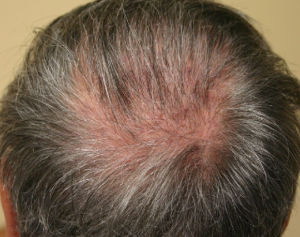 tj crown before