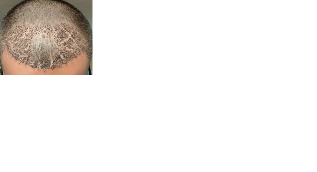 cracking head