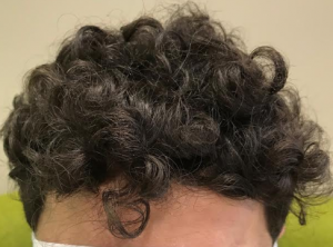full head of hair2