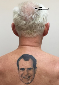 roger stone with tottoo