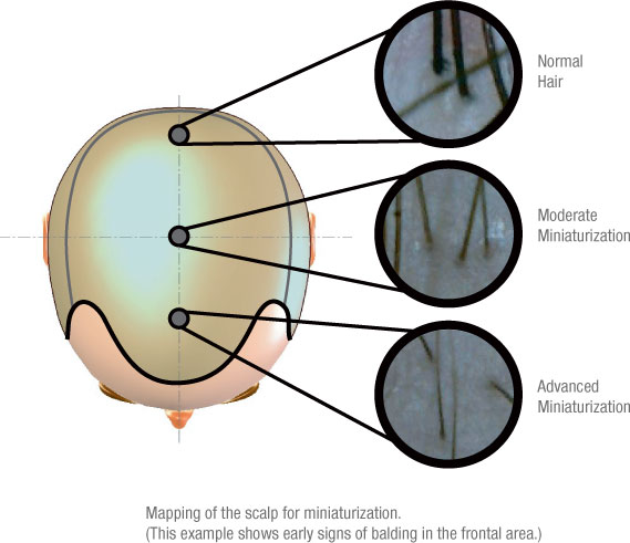 Miniaturization