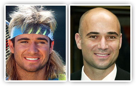 Andre Agassi
