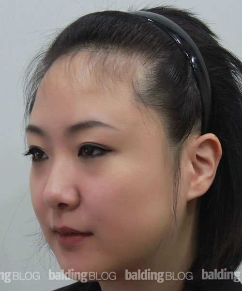 Before