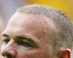 Rooney