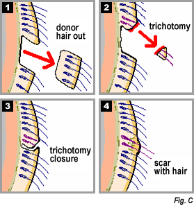 Figure C