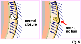 Figure D
