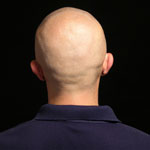 Bald
