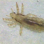 Lice