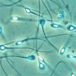 Sperm