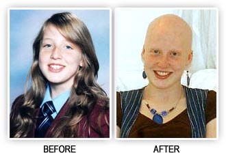 Bullied girl - before and after
