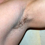 Armpit