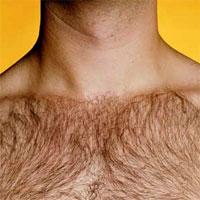 Body hair