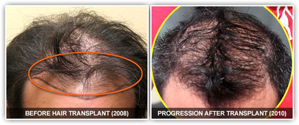 Gosselin hair