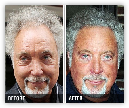 Tom Jones