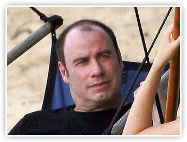 John Travolta balding