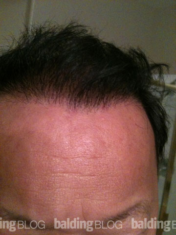 After