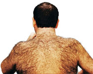 Back hair