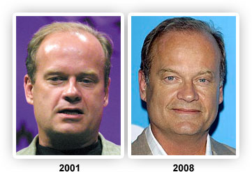 Kelsey Grammer