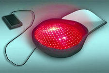 Lasercap