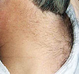Neck hair