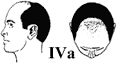 NW4A