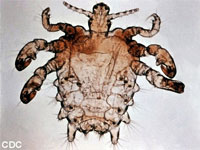 Crabs