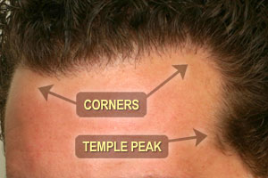 Temple vs Corner