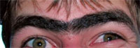 Unibrow